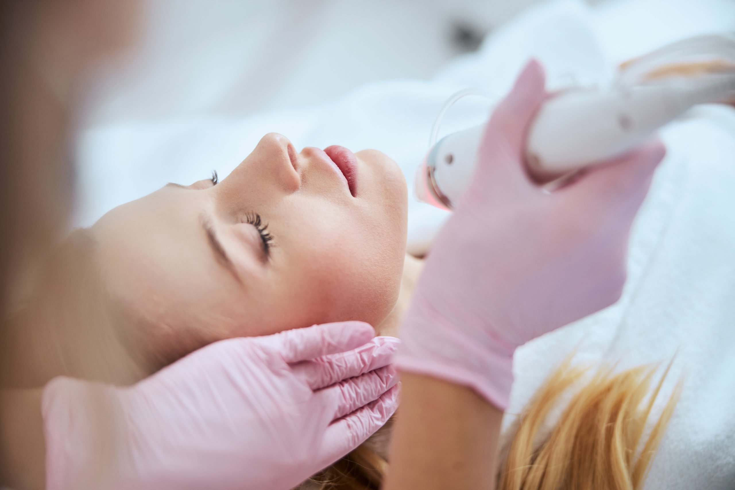 A Female getting microneedling | How Microneedling Can Rejuvenate Skin | CONTŌR