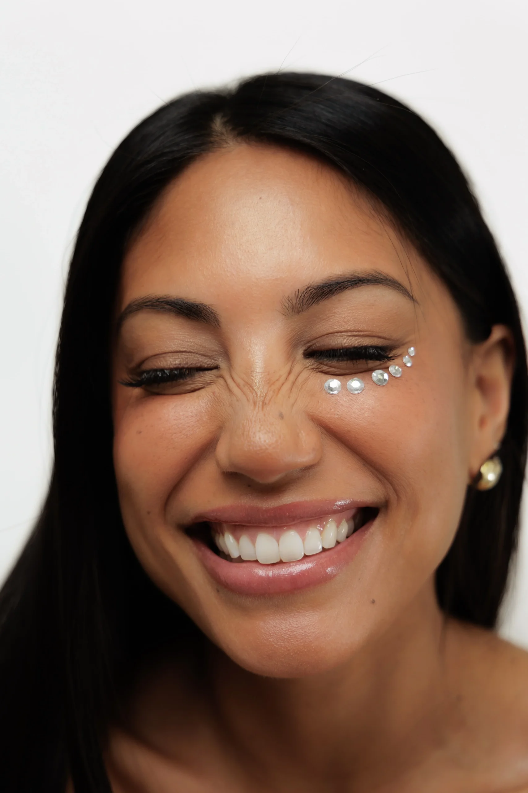 Biostimulatory Filler