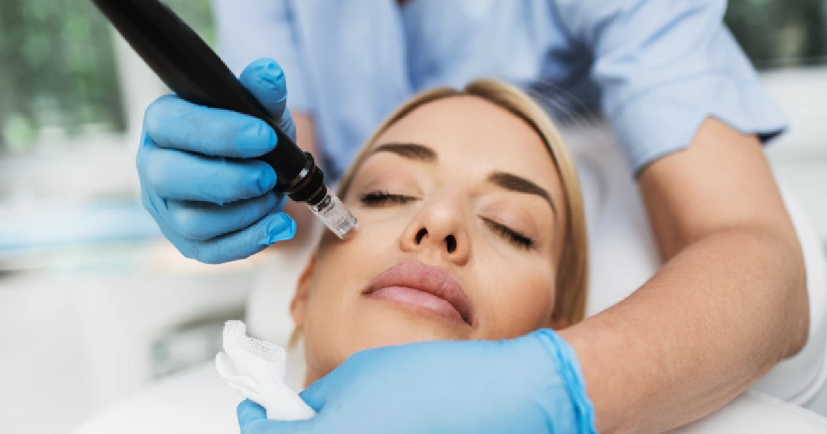 A women Receiving Regenerative Microneedling in New York, NY